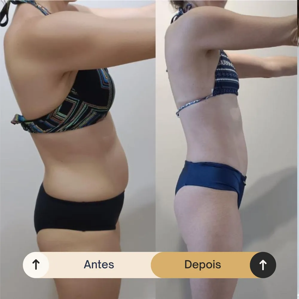 Antes e depois de aluna da RO Training